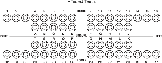 Toothy Diagram